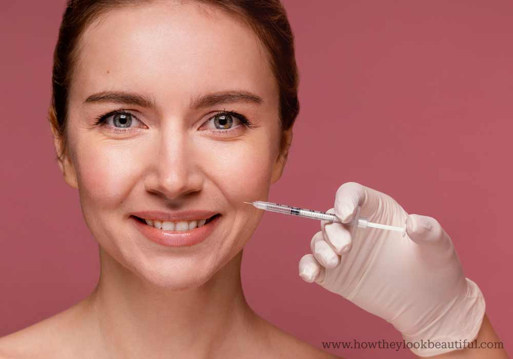 Botox for smile lines