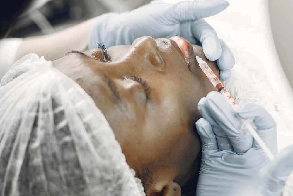 Botox around mouth