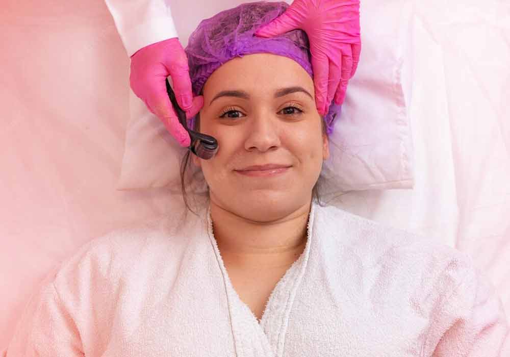 dermarolling is being performed on the face